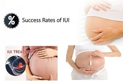 successful iui, iui procedure, success rate IUI, iui treatment